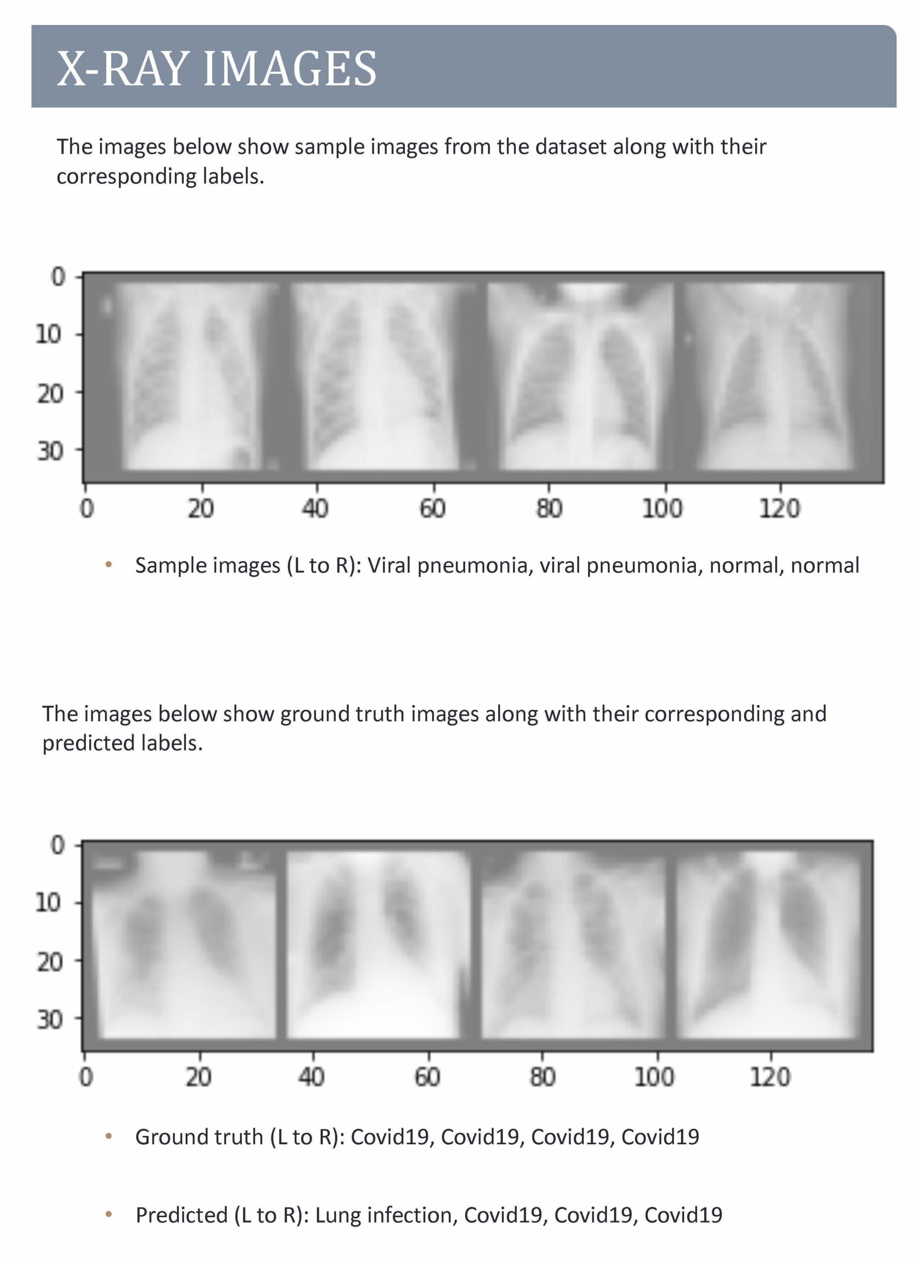 X-ray images for machine learning project